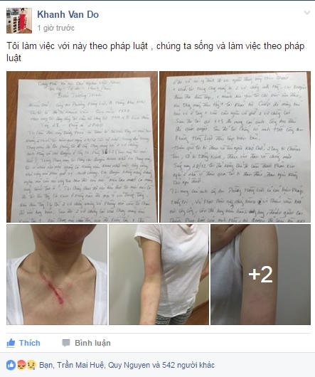 Những hình ảnh vết thương trên cơ thể kèm theo lá đơn tố cáo được chị Vân chia sẻ lên mạng xã hội.