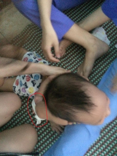 Trẻ bị bạo hành vì không chịu ăn.