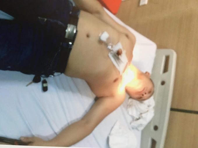 Ông Quảng được cấp cứu tại viện với vết thương trên cổ (ảnh do gia đình nạn nhân cung cấp).