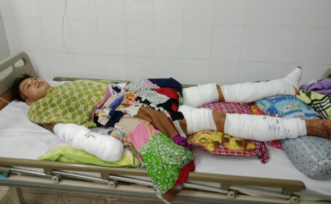 Ông bố đơn thân bị hoại tử tay chân do não mô cầu