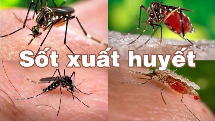 Tình trạng sốt xuất huyết, tay chân miệng đang diễn ra phức tạp. (Ảnh minh hoạ)