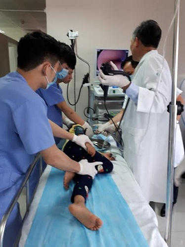 Kỹ thuật nội soi hiện đại giúp chẩn đoán viêm loét dạ dày, tá tràng ở trẻ em không đau.