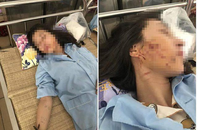 Chị G. đang điều trị tại Bệnh viện Đa khoa tỉnh Thanh Hóa.