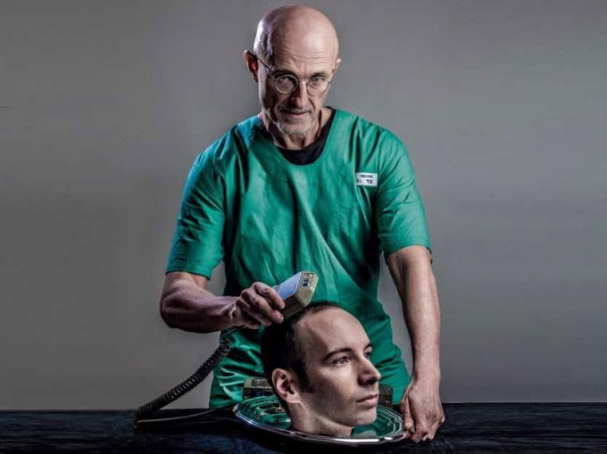 Tiến sĩ Sergio Canavero hy vọng được ủng hộ và tài trợ để thực hiện ca cấy ghép đầu người ở Trung Quốc vào tháng 12/2017.