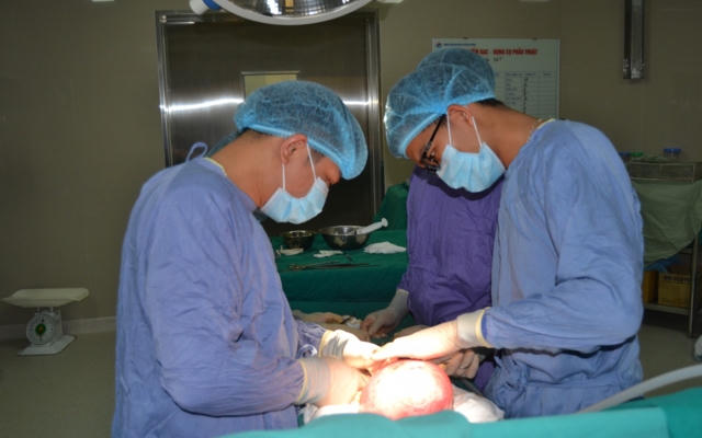 Khối u xơ to như thai 5 tháng trong tử cung người phụ nữ