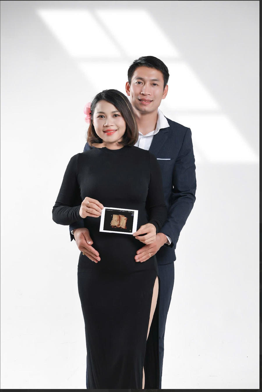 Đề xuất hỗ trợ đến 900.000 đồng cho sàng lọc trước sinh, giảm gánh nặng cho gia đình trẻ. Ảnh minh họa