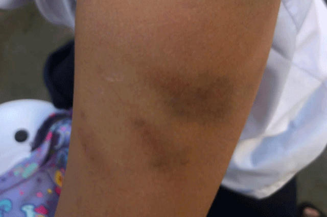 14-1776148640-vu-con-gai-9-tuoi-nghi-bi-me-ruot-tac-dong-vat-ly-34-vet-bam-nguoi-bo-tiet-lo-loat-tinh-tiet-gay-bat-ngo