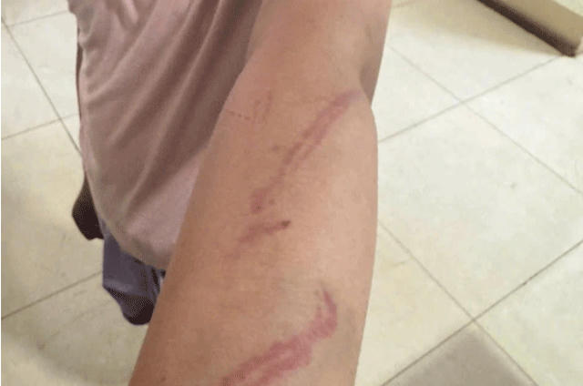 Cơ quan công an đang vào cuộc xác minh vụ việc (Ảnh: Bố nạn nhân cung cấp).