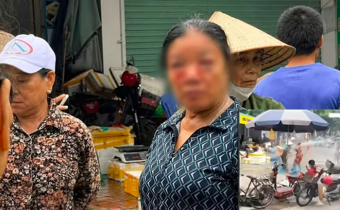 Người phụ nữ bán rau có dấu hiệu sưng mắt, máu chảy ra ở vùng mặt sau khi bị xịt vòi nước người. Người phụ nữ bán rau có dấu hiệu sưng mắt, máu chảy ra ở vùng mặt sau khi bị xịt vòi nước người.