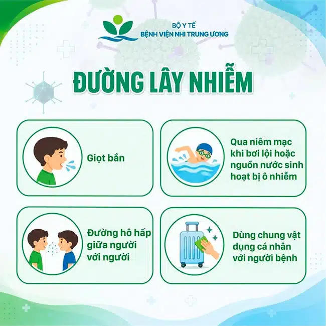 Triệu chứng điển hình và đường lây nhiễm của virus Adeno. (Ảnh: Bệnh viện Nhi Trung ương)