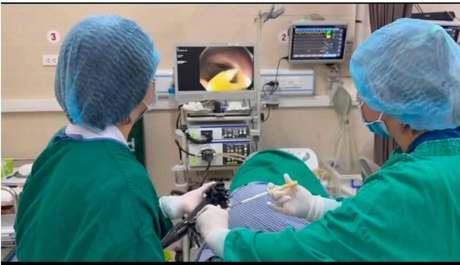 Các bác sĩ Bệnh viện 19-8 nội soi lấy nguyên vẹn ký sinh trùng ra khỏi cơ thể bệnh nhân. Ảnh BVCC