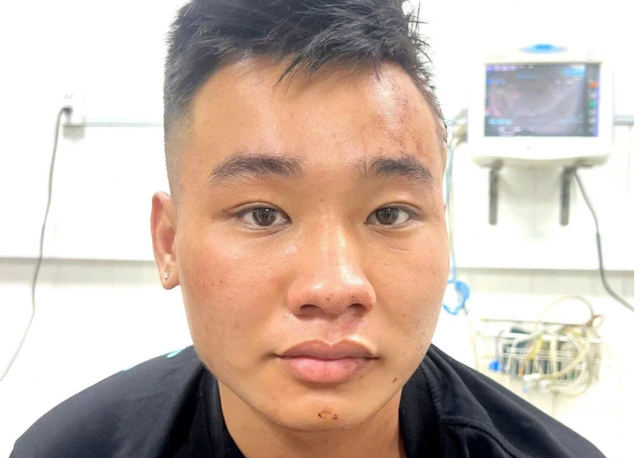 Nghi phạm Nguyễn Đức Anh (Ảnh: Công an cung cấp).
