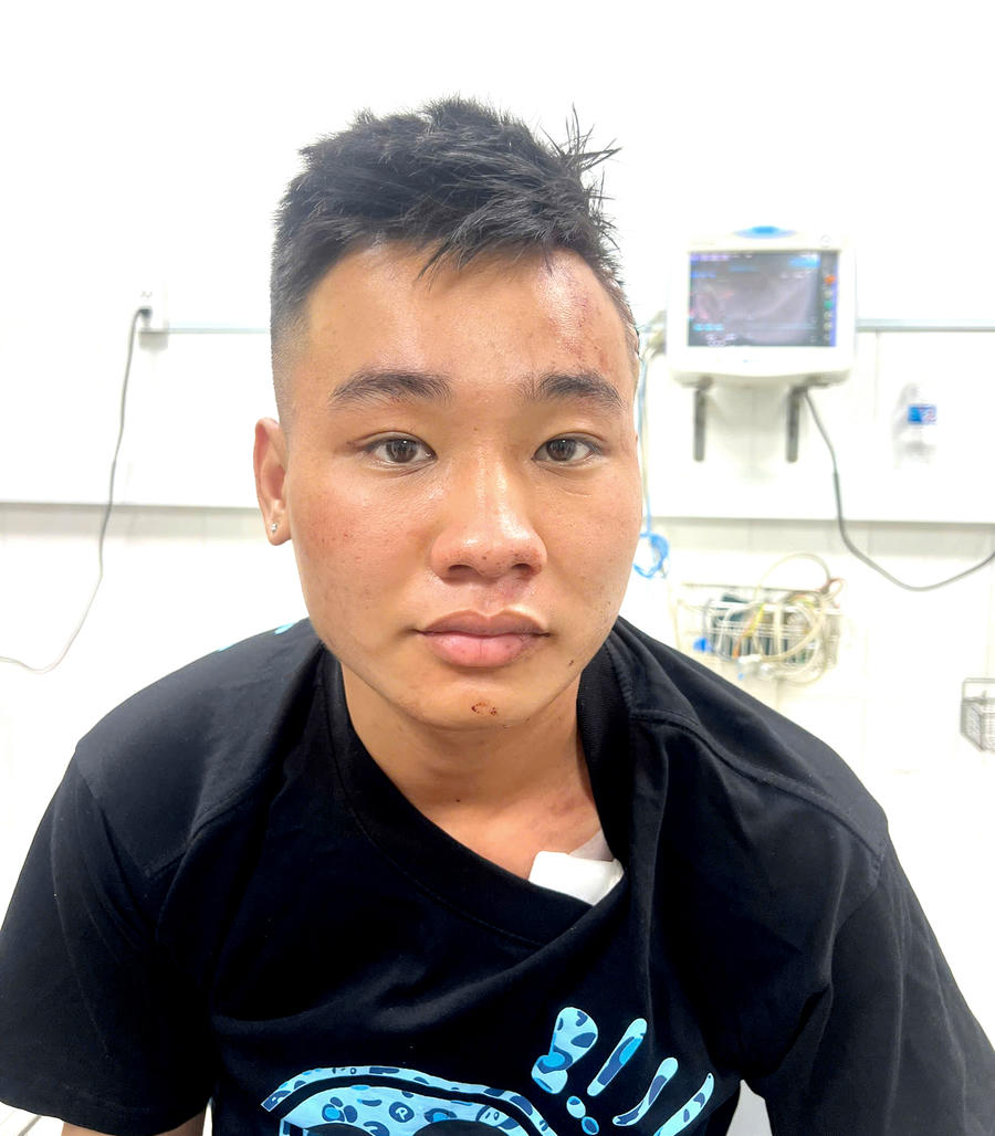 Đối tượng Nguyễn Đức Anh (ảnh: Công an Đồng Nai)