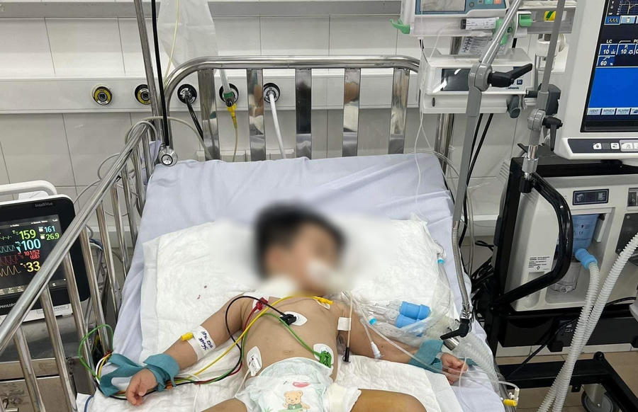 Bé trai hơn 1 tuổi ở TP.HCM mắc tay chân miệng chủng EV71 nhanh chóng chuyển từ độ 1 lên độ 4, phải đặt ECMO, lọc máu liên tục tại Bệnh viện Nhi đồng 1. Ảnh: Bảo Ngọc