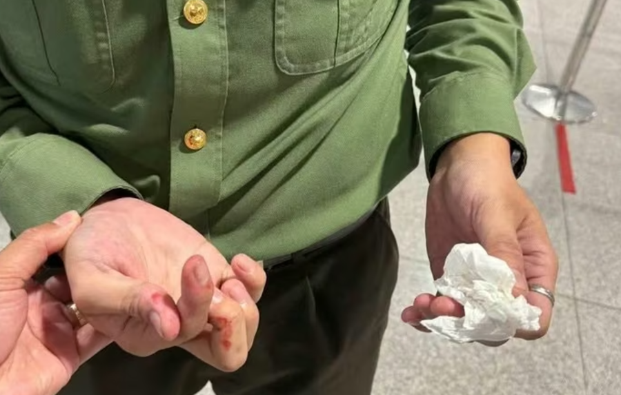 Tay của Đại úy Đặng Quốc Bình bị hành khách cắn chảy máu do bị ngất, mất ý thức (Ảnh: Công an cung cấp)